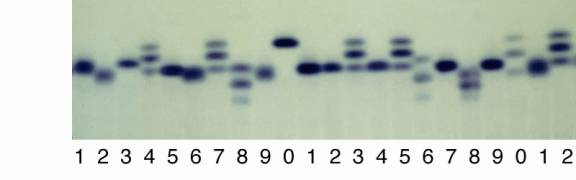 Gel4_6Pgd.jpg