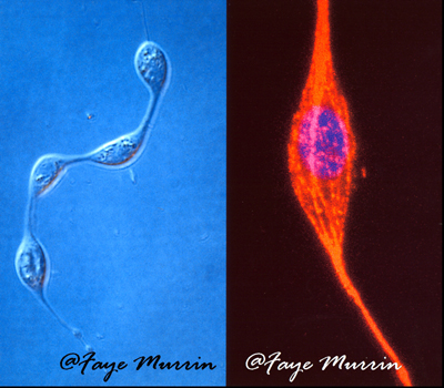 Protoplasts of Entomophaga